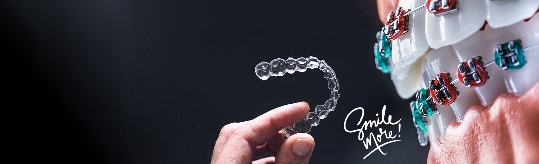 Ortodontik Tedaviler